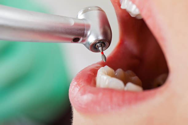 Best Urgent Dental Care  in Franconia, VA